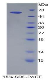 SDS-PAGE (Tgfbr3-297M).jpg